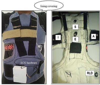 Preliminary Analysis of a Wireless and Wearable Electronic-Textile EASI-Based Electrocardiogram